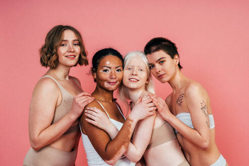 Group of multiethnic women with different kind of skin posing together in studio. Concept about body positivity and self acceptance - DMDF06731