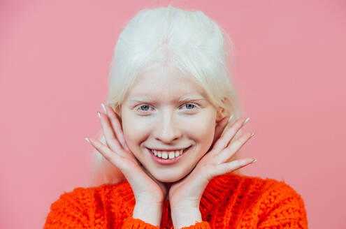 Lifestyle-Bild eines Albino-Mädchens, das im Studio posiert, Konzept über Körperbewusstsein, Vielfalt und Mode - DMDF06747