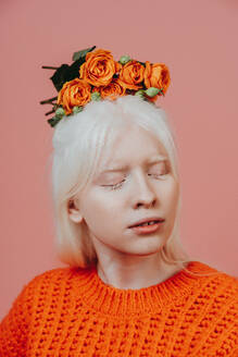 Lifestyle image of an albino girl posing in studio. Concept about body positivity, diversity, and fashion - DMDF06751