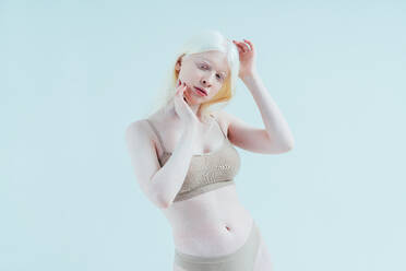 Schönes Bild eines Albino-Mädchens, das in einem Studio in Dessous posiert. Konzept über Körperbewusstsein, Vielfalt und Mode - DMDF06784