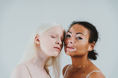 Group of multiethnic women with different kind of skin posing together in studio. Concept about body positivity and self acceptance - DMDF07559