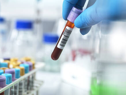 Pathologe hält Blutentnahmeröhrchen im Labor - ABRF01089