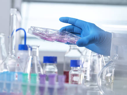 Hand eines Wissenschaftlers, der im Labor mit Stammzellen experimentiert - ABRF01090
