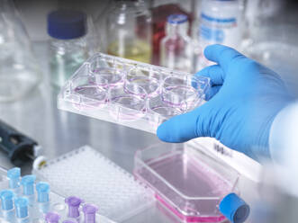 Senior-Wissenschaftler experimentiert im Labor mit Stammzellen - ABRF01091