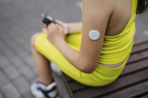 Mädchen mit Diabetes überprüft ihren Blutzuckerspiegel an einer Insulinpumpe und trägt einen CGM-Sensor - HAPF03423