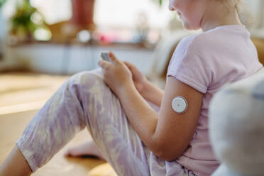 Diabetikerin mit kontinuierlichem Blutzuckermessgerät am Arm: Das CGM-Gerät erleichtert das Leben der Schülerin, da es ihr hilft, ihre Krankheit zu bewältigen und sich auf andere Aktivitäten zu konzentrieren. - HPIF31402