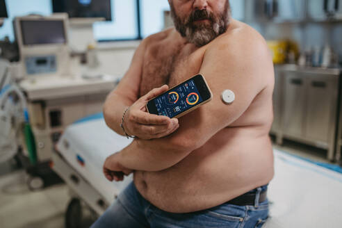 Ein Patient verbindet ein kontinuierliches Glukosemessgerät mit seinem Smartphone, um seinen Blutzuckerspiegel in Echtzeit zu überprüfen. Ein übergewichtiger Mann hat ein hohes Risiko, an Typ-2-Diabetes zu erkranken. Konzept der Gesundheitsrisiken von Übergewicht und Adipositas. - HPIF31479