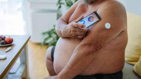Übergewichtiger Diabetiker, der sein CGM mit einem Smartphone verbindet, um seinen Blutzuckerspiegel in Echtzeit zu überwachen. Nahaufnahme eines Diabetikers, der mit einem kontinuierlichen Glukosemessgerät seinen Blutzuckerspiegel überprüft. - HPIF32964