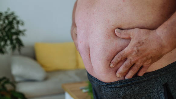 Nahaufnahme eines fettleibigen Mannes, der sich den Bauch hält. Vorstehender fettleibiger Bauch, Gefahren durch Bauchfett. - HPIF32967