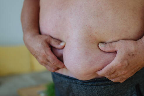 Nahaufnahme eines fettleibigen Mannes, der sich den Bauch hält. Vorstehender fettleibiger Bauch, Gefahren durch Bauchfett. - HPIF32968
