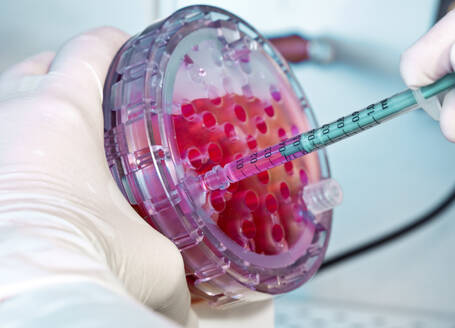 Wissenschaftlerin bei der Arbeit mit Zellen in einer Labor-Petrischale - ISF26754