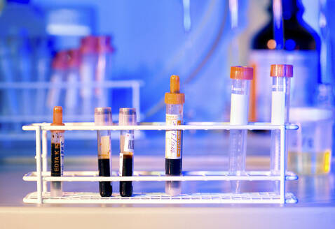 Eine bunte wissenschaftliche Laborszene mit Reagenzgläsern, die mit Proben gefüllt sind - ISF26759